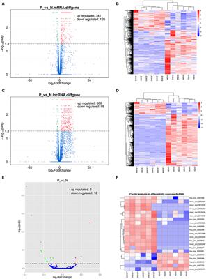 Transcriptome Sequencing Analysis of Peripheral Blood of Type 2 Diabetes Mellitus Patients With Thirst and Fatigue